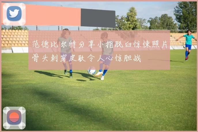 范德比尔特分享小指脱臼惊悚照片骨头刺穿皮肤令人心惊胆战